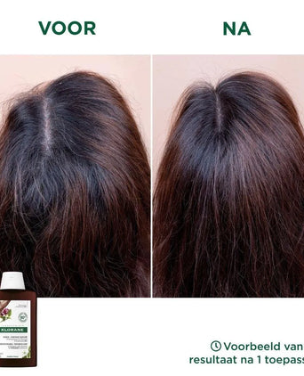 Klorane anti-hair loss shampoo Quinine/Edelweiss (400 ml) - Hair Growth Specialist