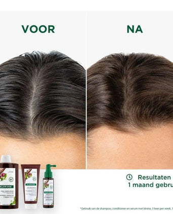 Klorane anti-hair loss treatment - Hair Growth Specialist
