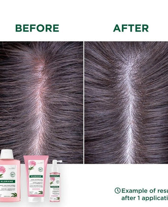Klorane shampoo Peony - sensitive scalp (400 ml) - Hair Growth Specialist