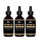 Mzel Batana oil 3-pack (3x60 ml) - Hair Growth Specialist