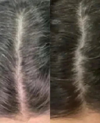 Neofollics anti-grey hair tablets (3-pack) - Hair Growth Specialist