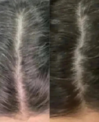 Neofollics anti-grey hair tablets - Hairgivers