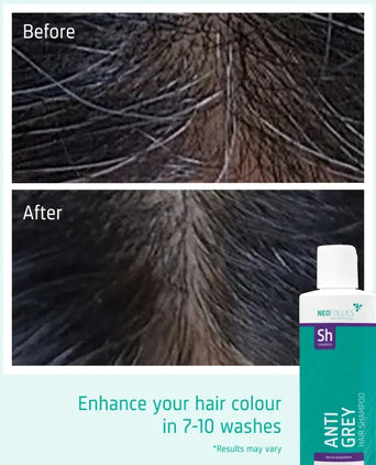 Shampoo antigrigio Neofollics