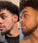 Neofollics beard growth kit - Hairgivers