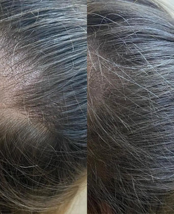 Panthrix hair growth serum 3-pack (Redensyl) - Hair Growth Specialist
