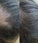 Panthrix hair growth serum (Redensyl) - Hair Growth Specialist