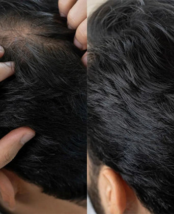 Panthrix hair growth serum (Redensyl) - Hair Growth Specialist