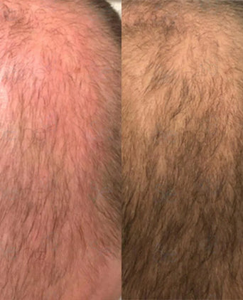 Panthrix hair growth serum (Redensyl) - Hair Growth Specialist