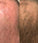 Panthrix hair growth serum (Redensyl) - Hair Growth Specialist