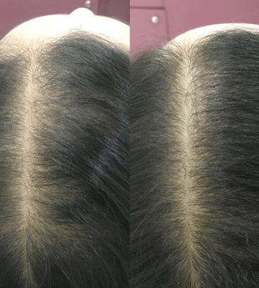 Revita conditioner (925 ml) - Hair Growth Specialist