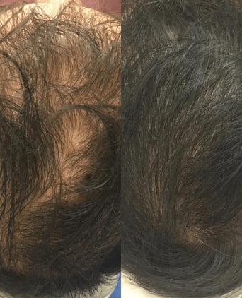 Revita hair growth shampoo + conditioner (925 ml) - Hair Growth Specialist