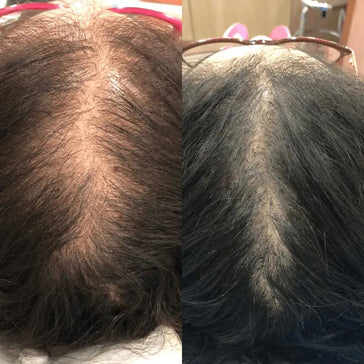 Revita champú + acondicionador para el crecimiento del cabello (925 ml)