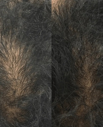 Revita tablets for hair growth (3 months) - Hair Growth Specialist