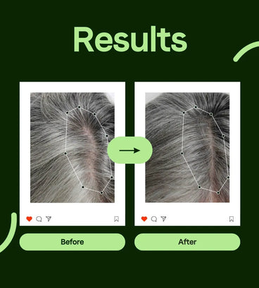 Scandinavian Biolabs Bio-Pilixin conditioner women (250 ml) - Hair Growth Specialist