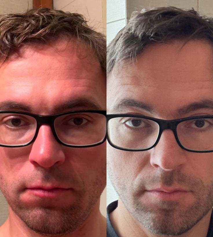 Scandinavian Biolabs Bio-Pilixin Hairline Booster