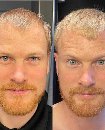 Scandinavian Biolabs Bio-Pilixin shampoo + conditioner men (250 ml) - Hair Growth Specialist