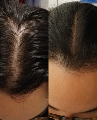 Scandinavian Biolabs Bio-Pilixin shampoo + conditioner women (250 ml) - Hair Growth Specialist