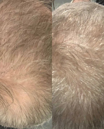 Scandinavian Biolabs Bio-Pilixin shampoo men (250 ml) - Hair Growth Specialist