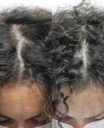 Scandinavian Biolabs hair growth treatment (women) - Hair Growth Specialist