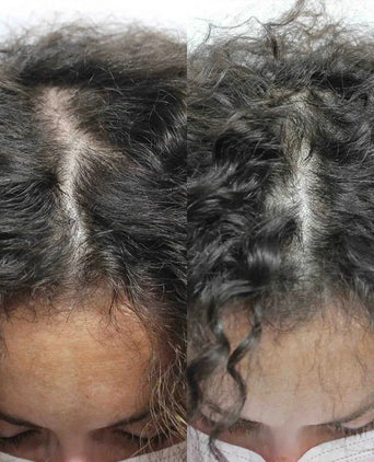 Scandinavian Biolabs hair growth treatment (women) - Hairgivers
