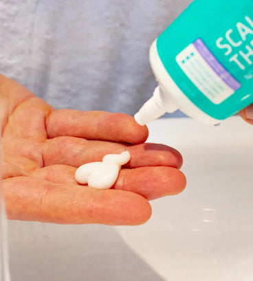 Seborrheic dermatitis scalp treatment - Hair Growth Specialist