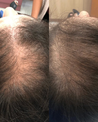 Spectral.CSF (Adenosine) lotion - Hair Growth Specialist