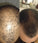 Spectral DNC-N (Nanoxidil) lotion - Hair Growth Specialist