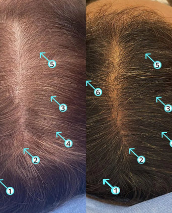 Spectral.DNC-S (Melanex) lotion - Hair Growth Specialist