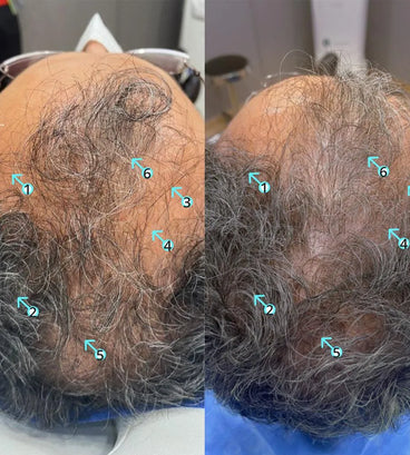 Spectral.DNC-S (Melanex) lotion - Hair Growth Specialist