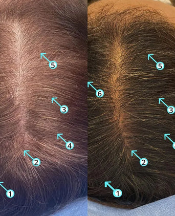 Spectral.DNC-S (Melanex) lotion - Hairgivers