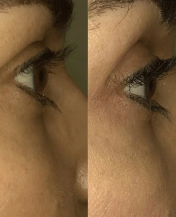 Spectral.LASH eyelash growth serum - Hair Growth Specialist