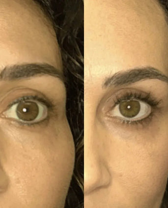 Spectral.LASH eyelash growth serum - Hair Growth Specialist