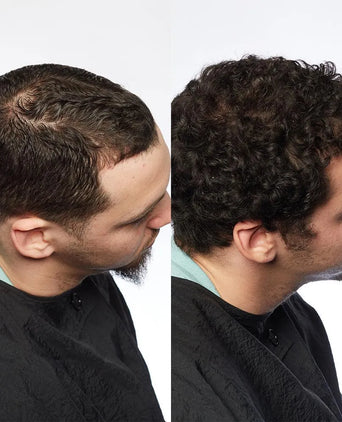 Theradome LH80 PRO laser helmet - Hair Growth Specialist