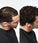 Theradome LH80 PRO laser helmet - Hairgivers