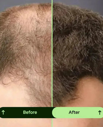 Toppik hair thickener color spray - Hair Growth Specialist