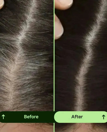 Toppik hair thickener color spray - Hair Growth Specialist