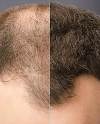 Toppik hair thickener color spray - Hair Growth Specialist
