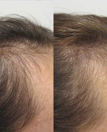 Viviscal hair growth tablets for women (1 month) - Hair Growth Specialist