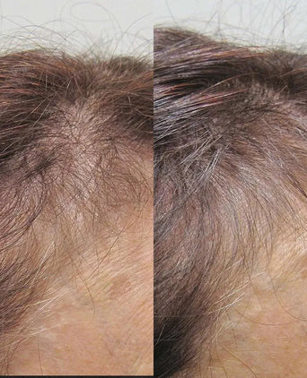 Viviscal hair growth tablets for women (1 month) - Hair Growth Specialist