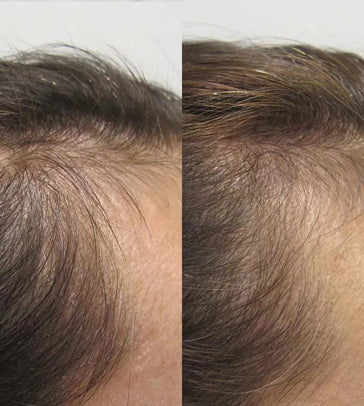 Viviscal hair growth tablets for women (1 month) - Hairgivers