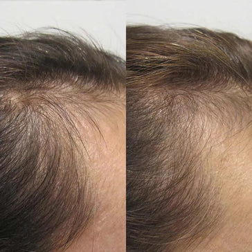 Viviscal hair growth tablets for women (3 months) - Hairgivers