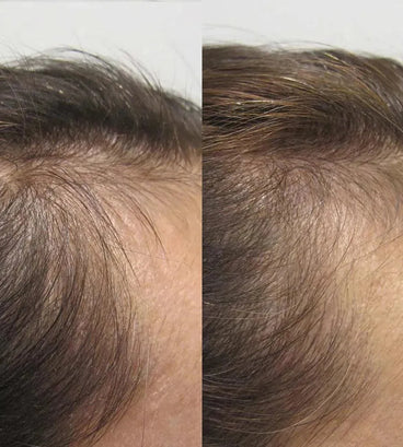 Viviscal hair growth tablets for women (3 months) - Hairgivers